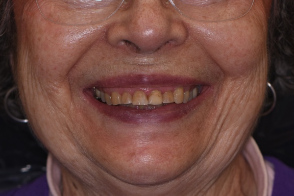 Before Image