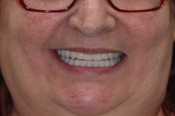 After Image