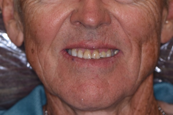 Before Image