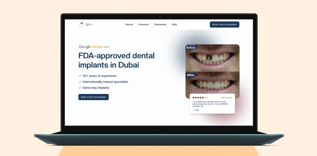 Laptop screen displaying a dental implant clinic website advertising FDA-approved dental implants in Dubai with over 20 years of experience, internationally trained specialists, and same-day implants, featuring before and after photos of dental implant treatment and a 5-star Google review.