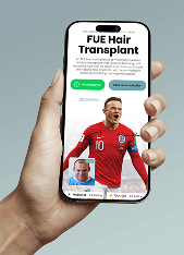 Hand holding a smartphone displaying a FUE Hair Transplant webpage with a photo of a man in a red soccer jersey and a smaller before-and-after image of a man's hair transplant results.