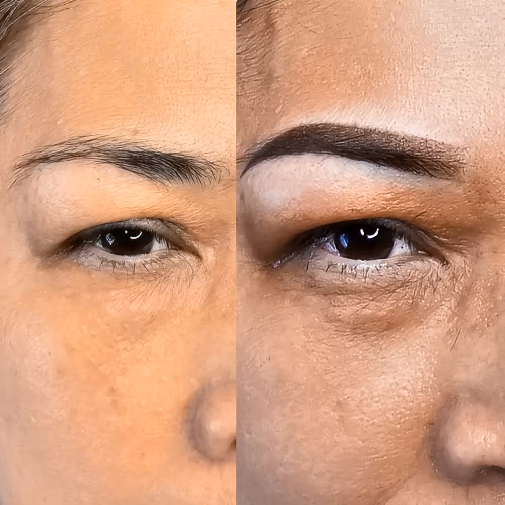 Close-up before and after of an eyebrow showing enhancement with darker, fuller shape and defined arch.