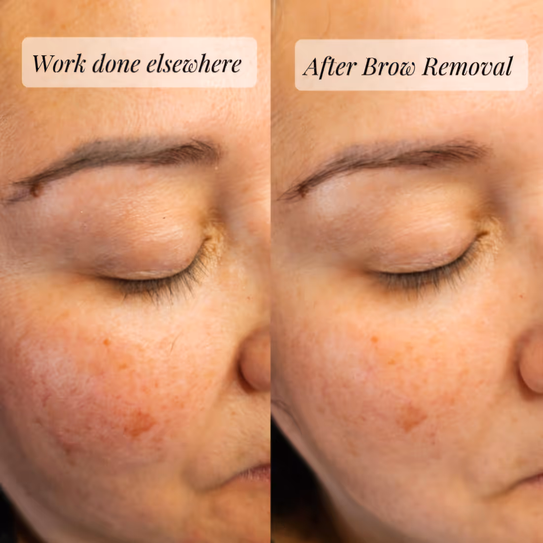 Side-by-side close-up of a woman's eye area showing eyebrow work before and after removal.