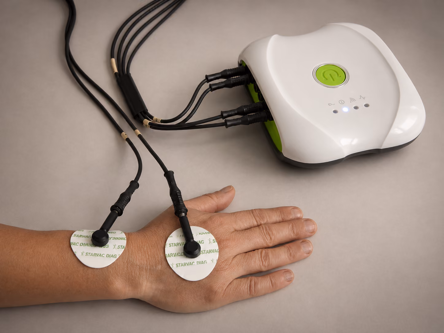 Test du pincement sur la cuisse révélant l’aspect peau d’orange et la cellulite