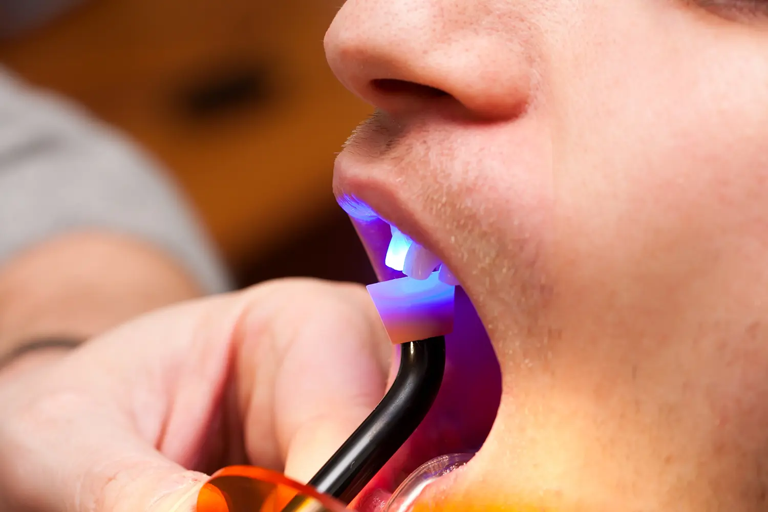 Cosmetic Bonding in Smyrna, GA | Dental Arts of Smyrna