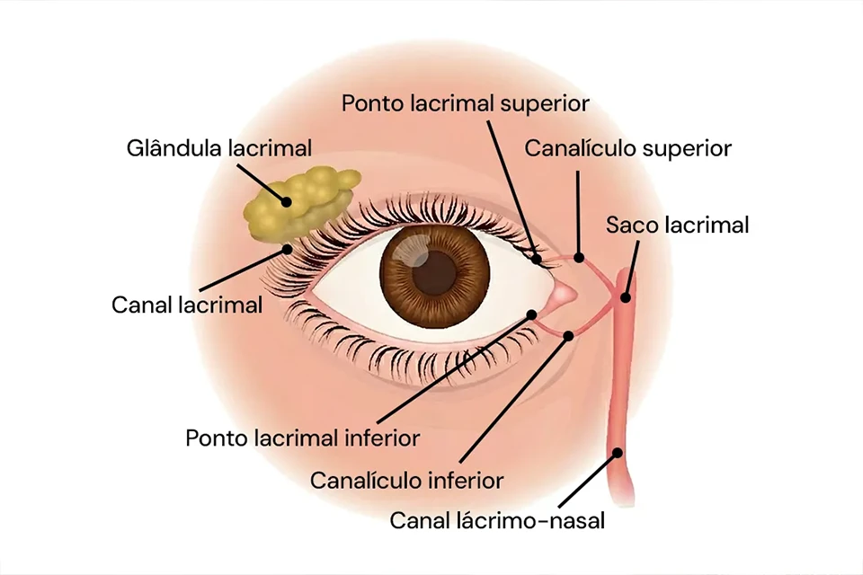 Infográfico comparativo mostrando um olho com cristalino opaco (catarata) e um olho com lente intraocular implantada recuperando a visão