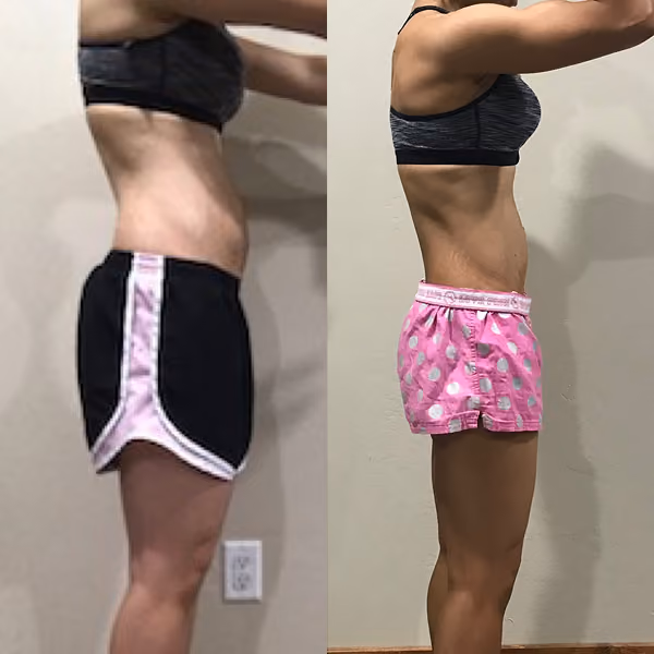 Side-by-side comparison of a woman’s midsection before and after weight loss wearing different shorts.