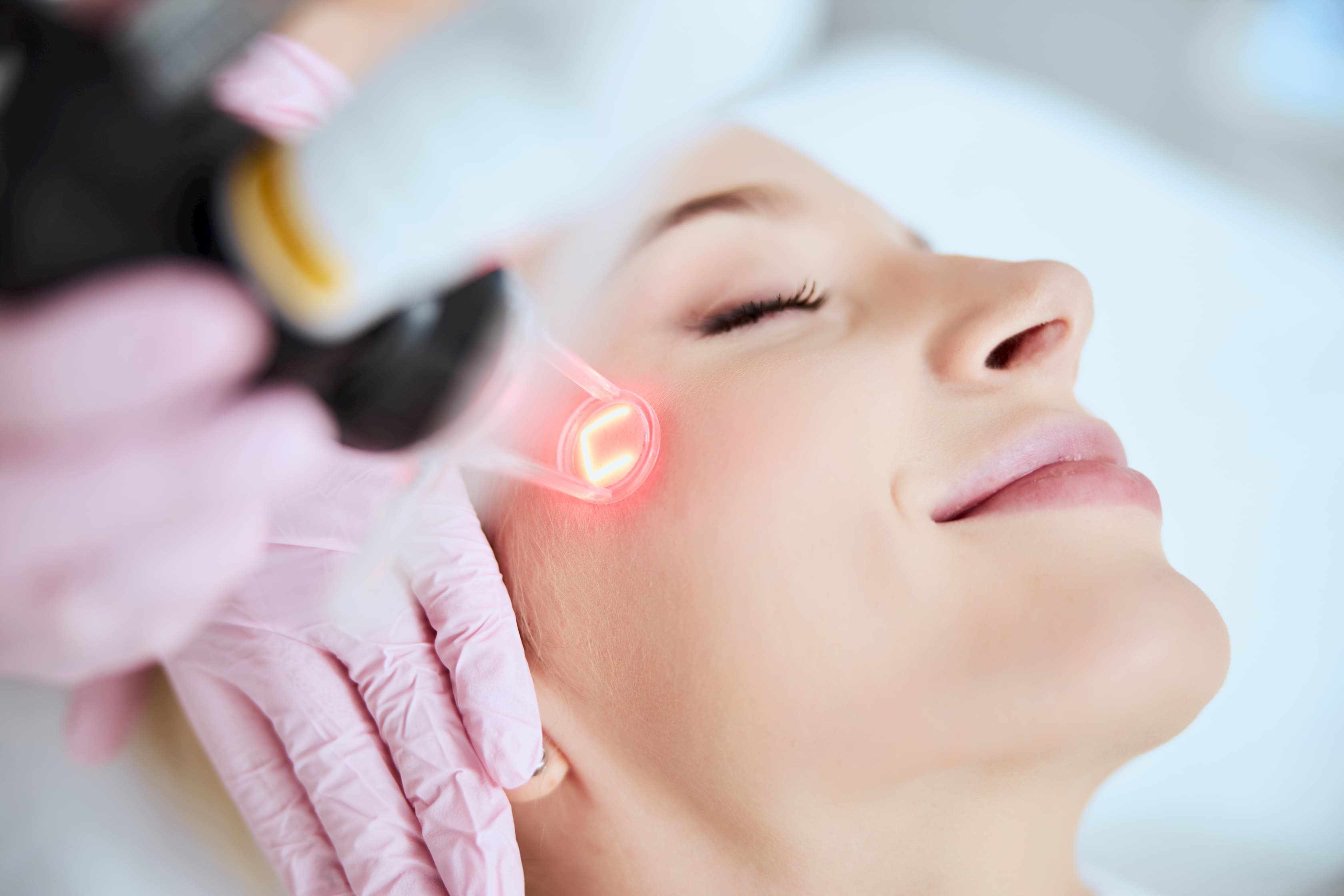 woman getting laser skin treatment on face