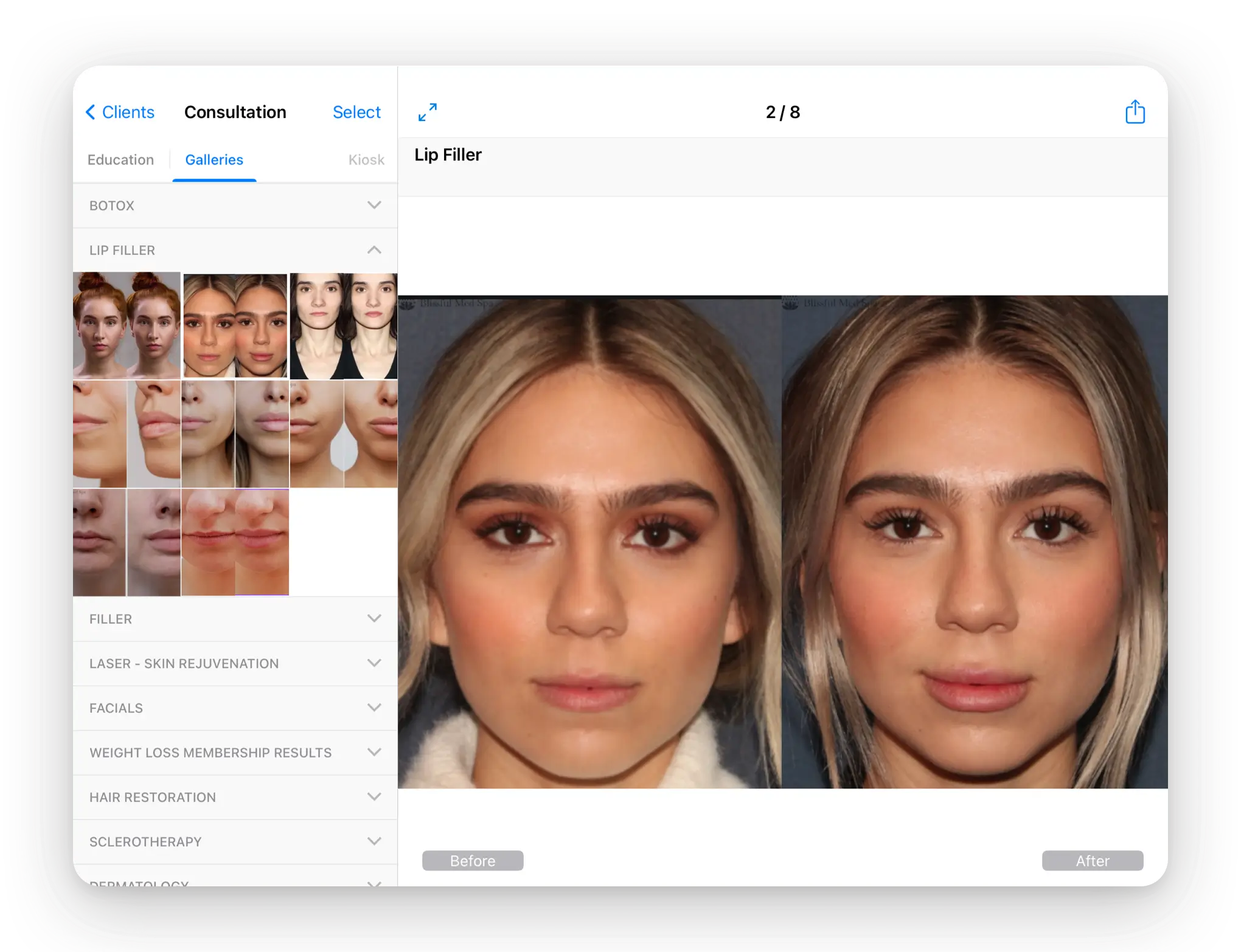 Before and after comparison using a side by side and slider view
