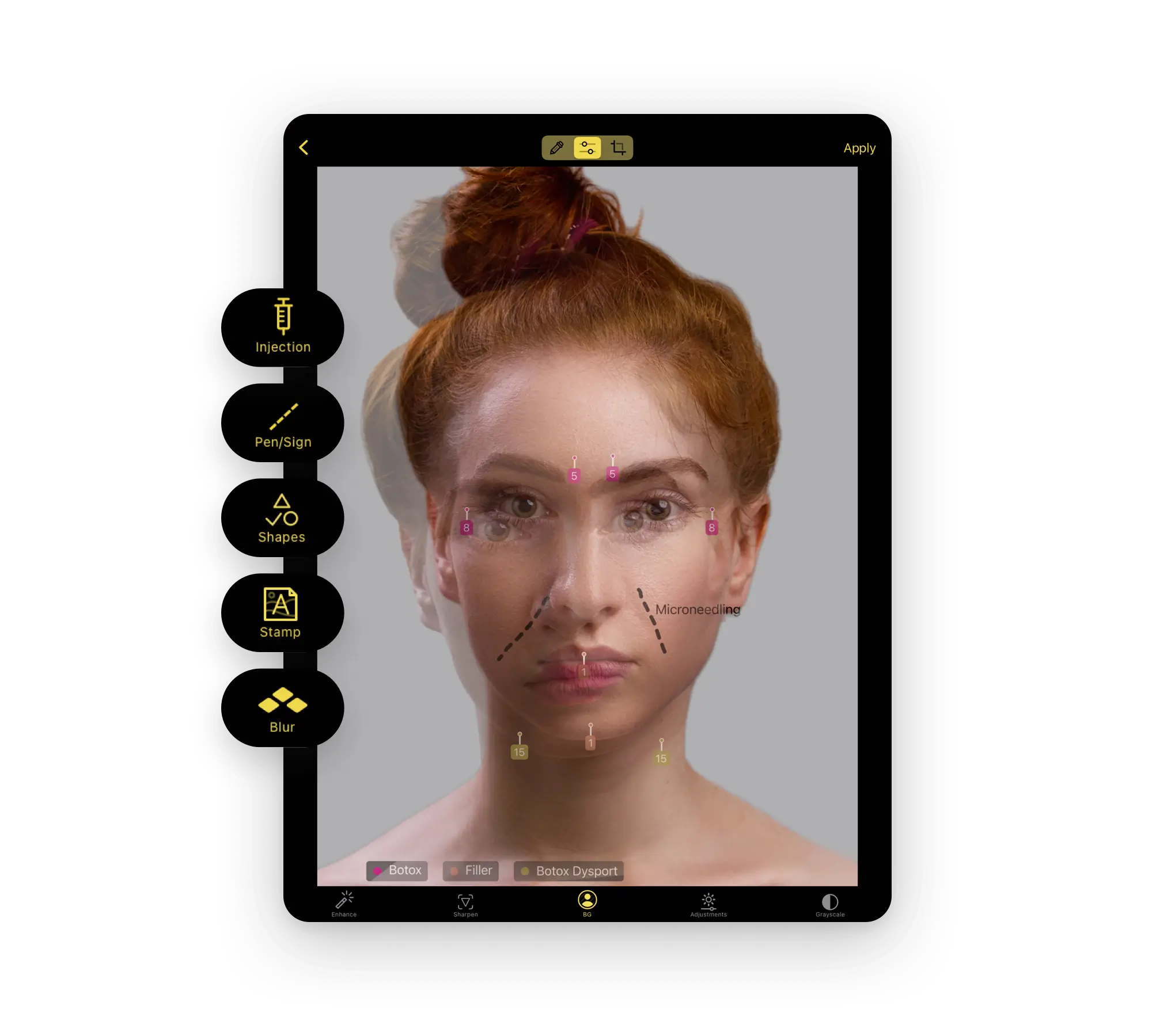Guided photo capture with a ghosting overlay and positioning template
