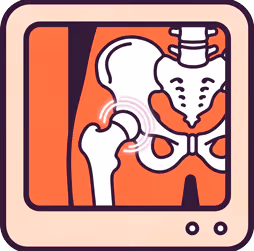 Chirurgie de la hanche