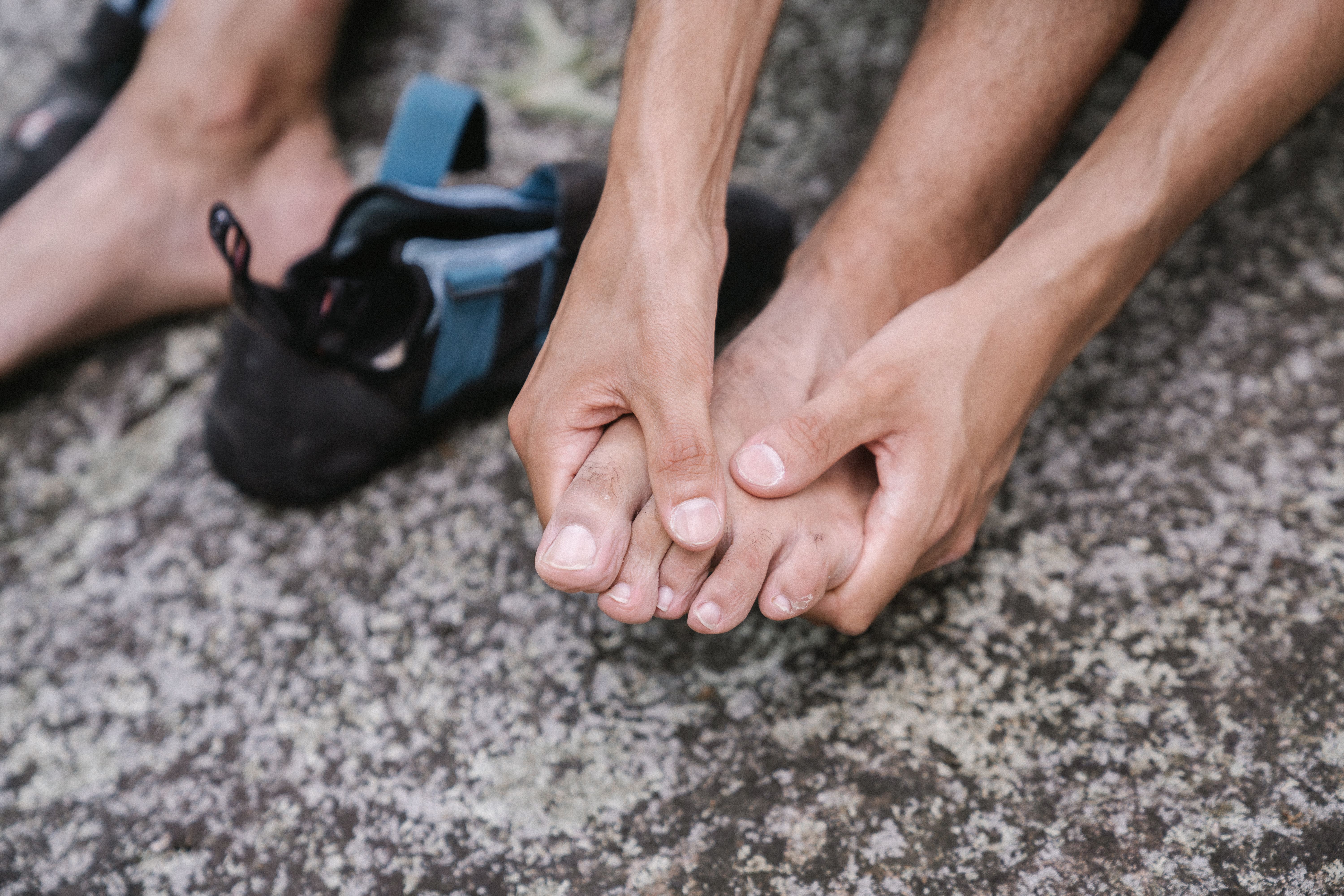 Hallux valgus : opérer ou pas ? Ce que dit la chirurgie orthopédique moderne