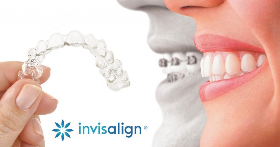 Invisalign orthodontics