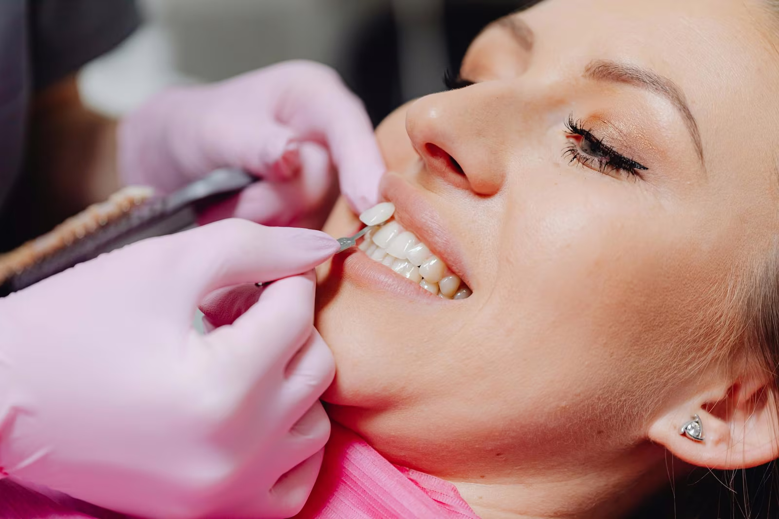 Custom night guard protecting porcelain veneers, fitted at Sola Dental Spa in Staten Island