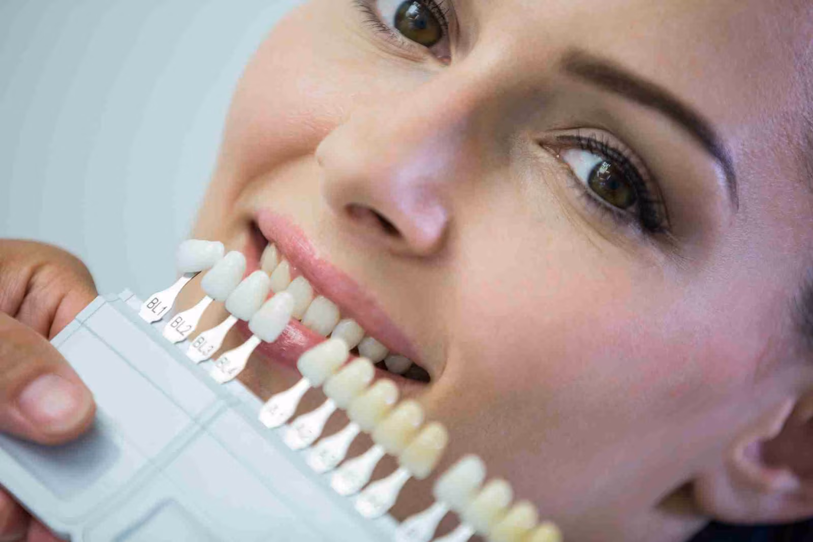 Porcelain veneers vs. composite veneers.