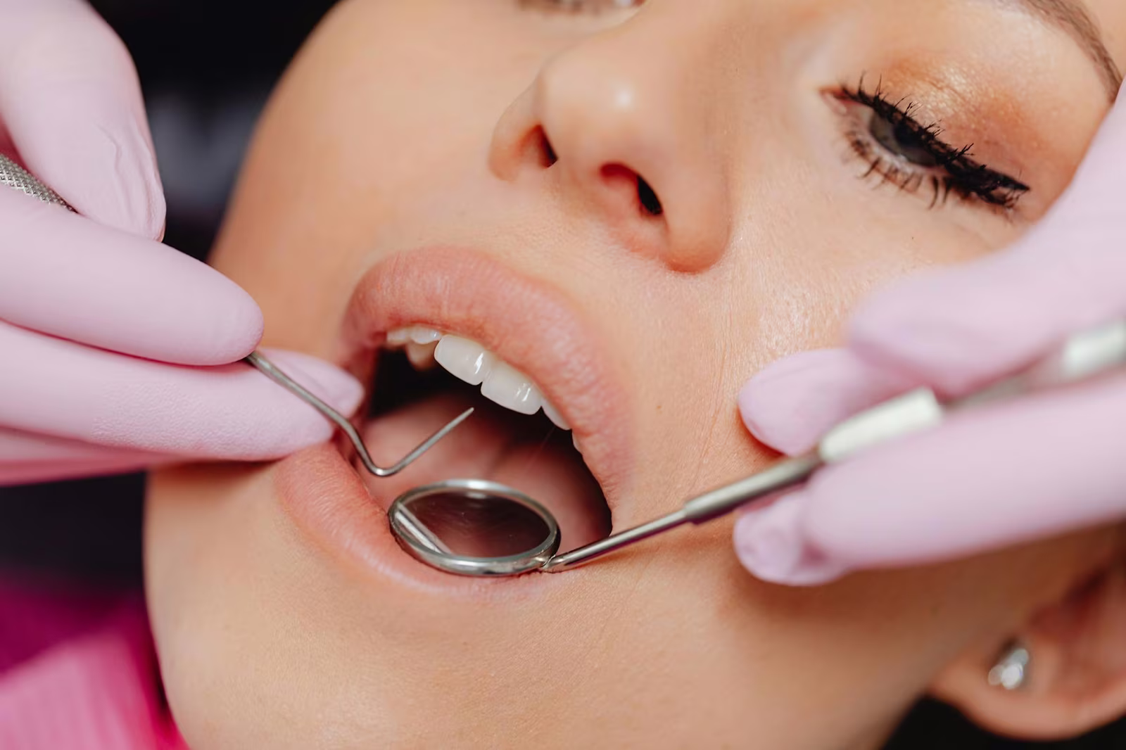 Cosmetic dental treatments compared by expected lifespan, from whitening to porcelain veneers