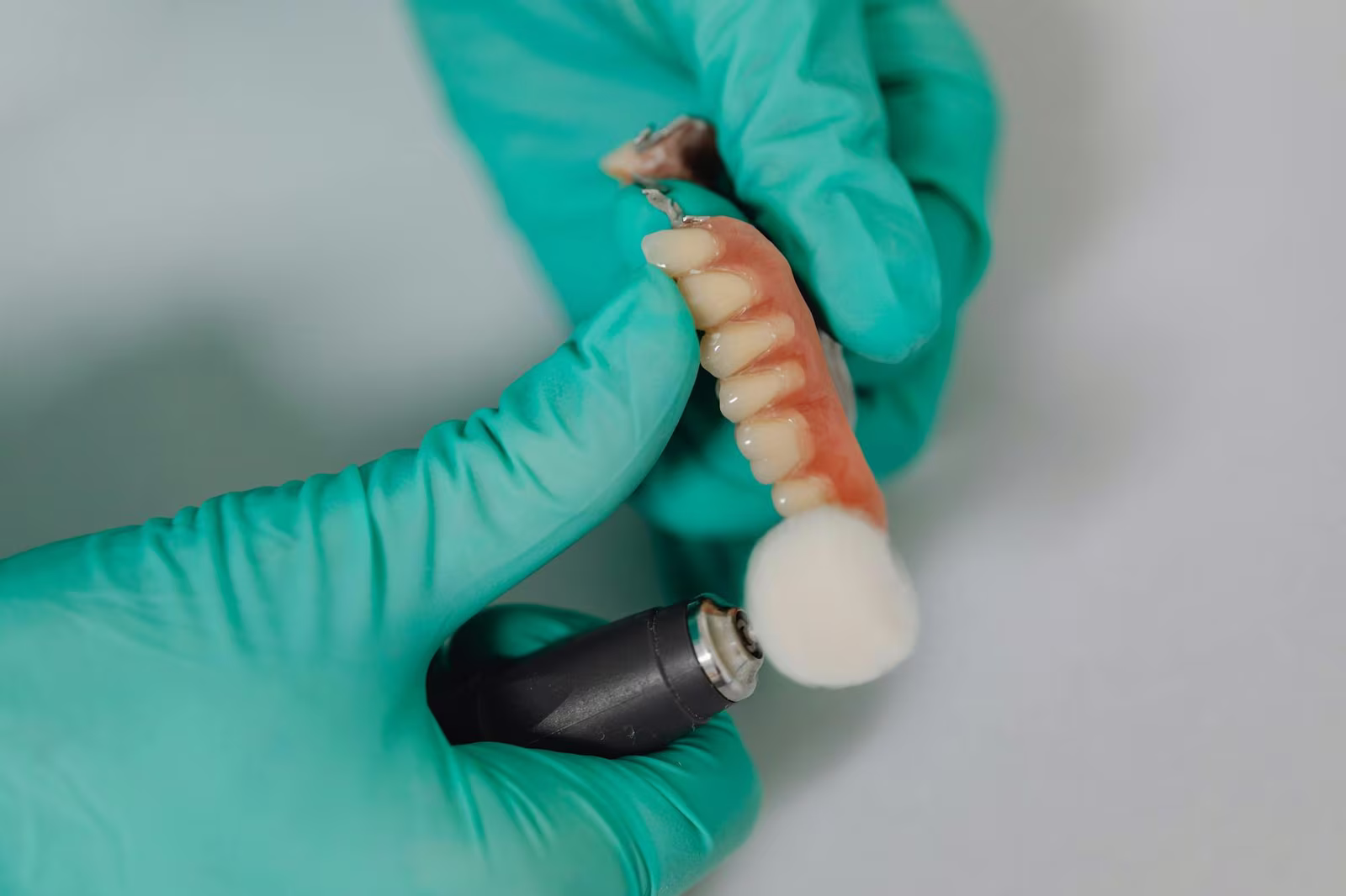 What Dental Implants Are & How They Function?