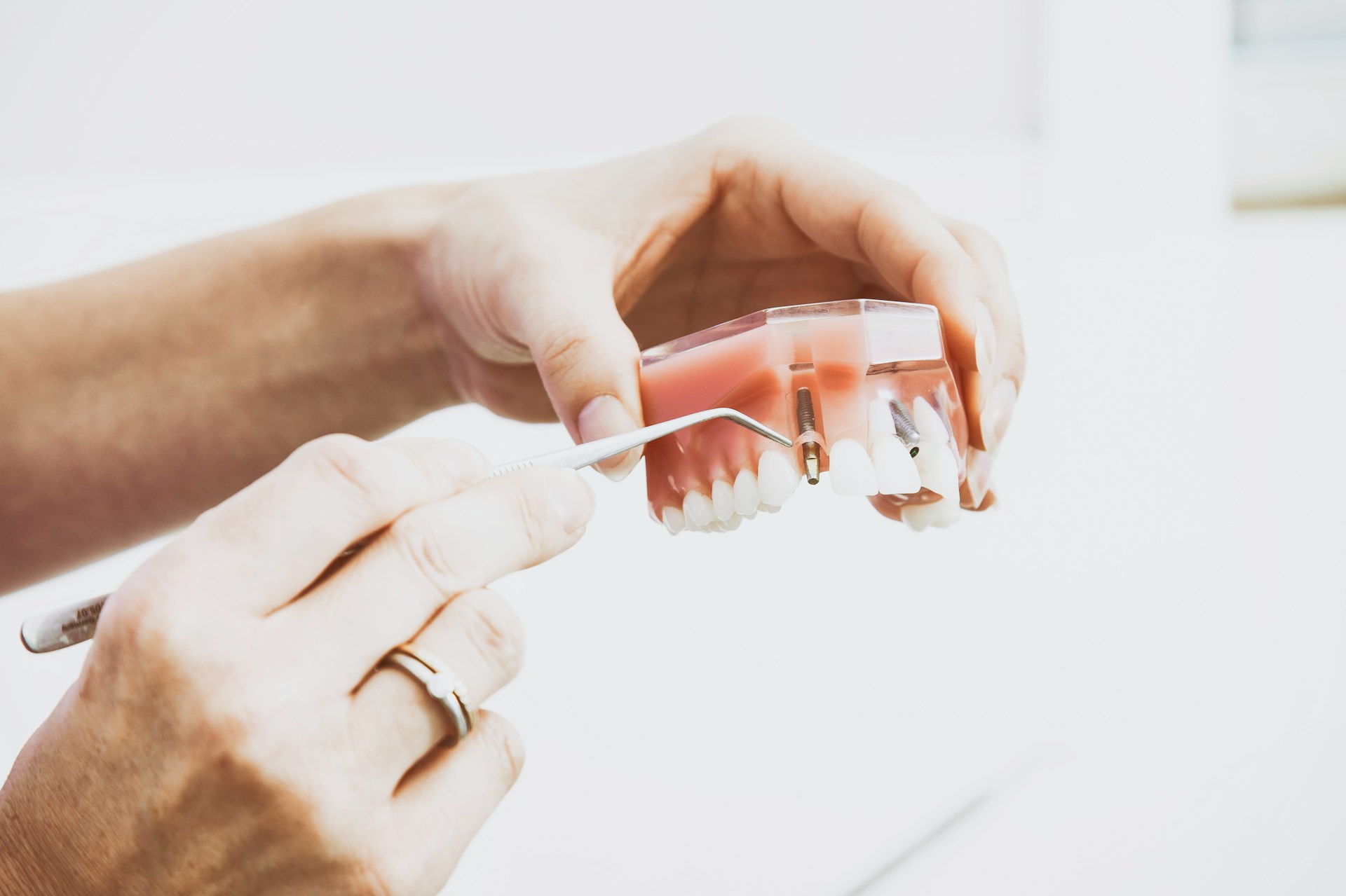 Dental implant procedure