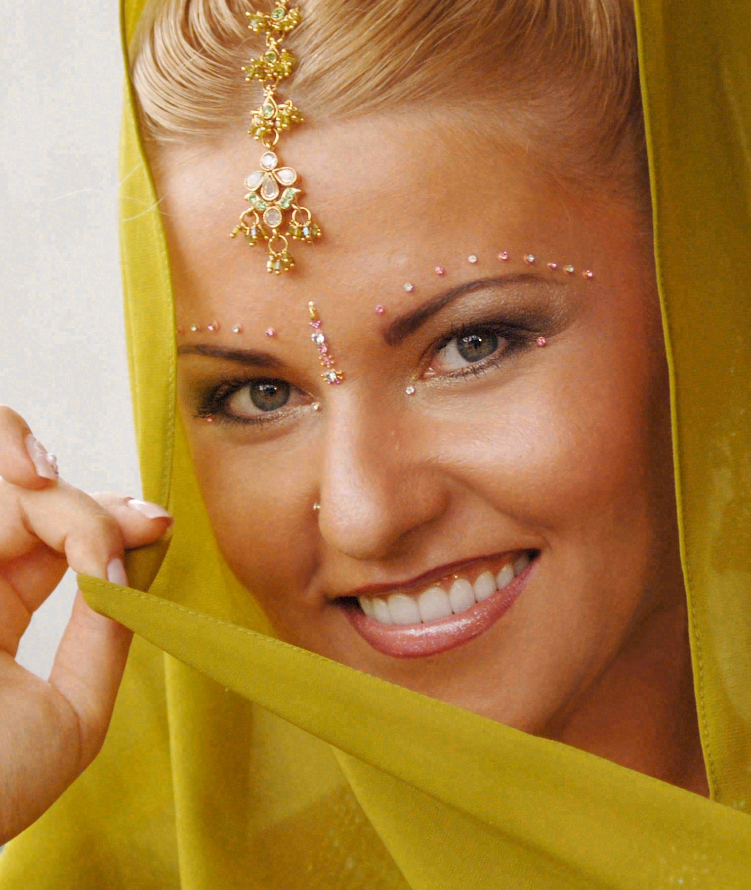 After porcelain veneers at Sola Dental Spa