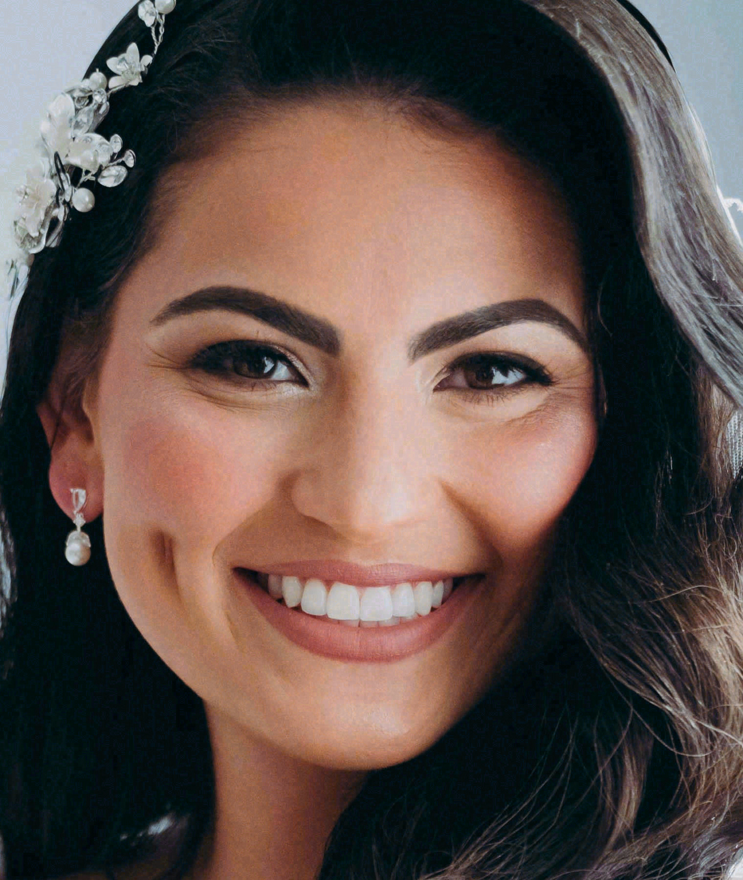 After porcelain veneers at Sola Dental Spa