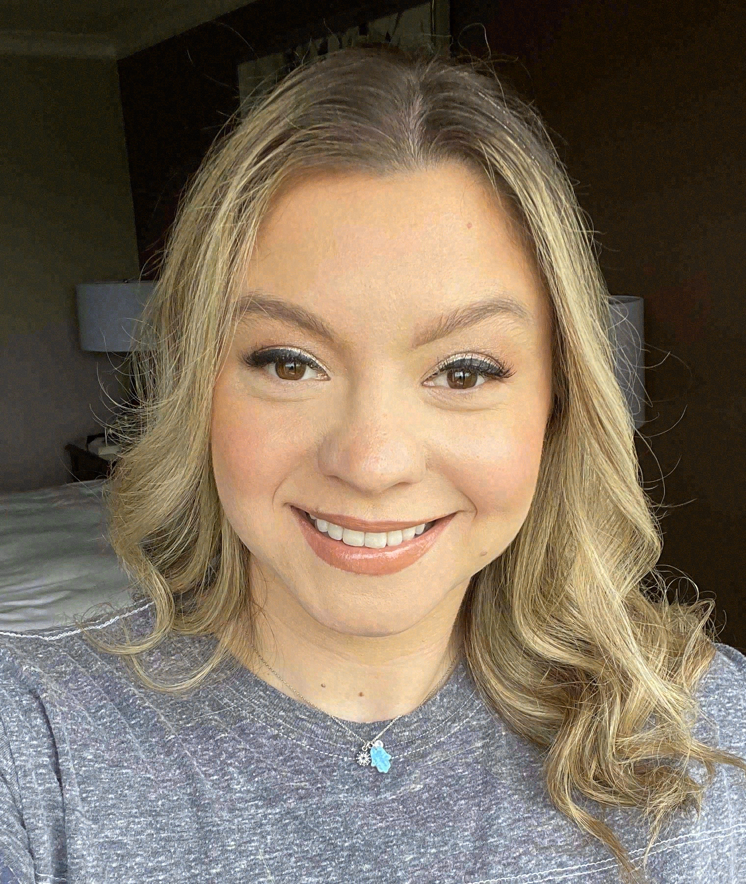 After porcelain veneers at Sola Dental Spa