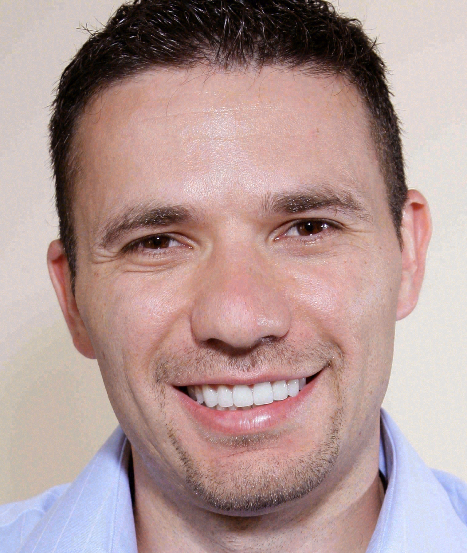 After porcelain veneers at Sola Dental Spa