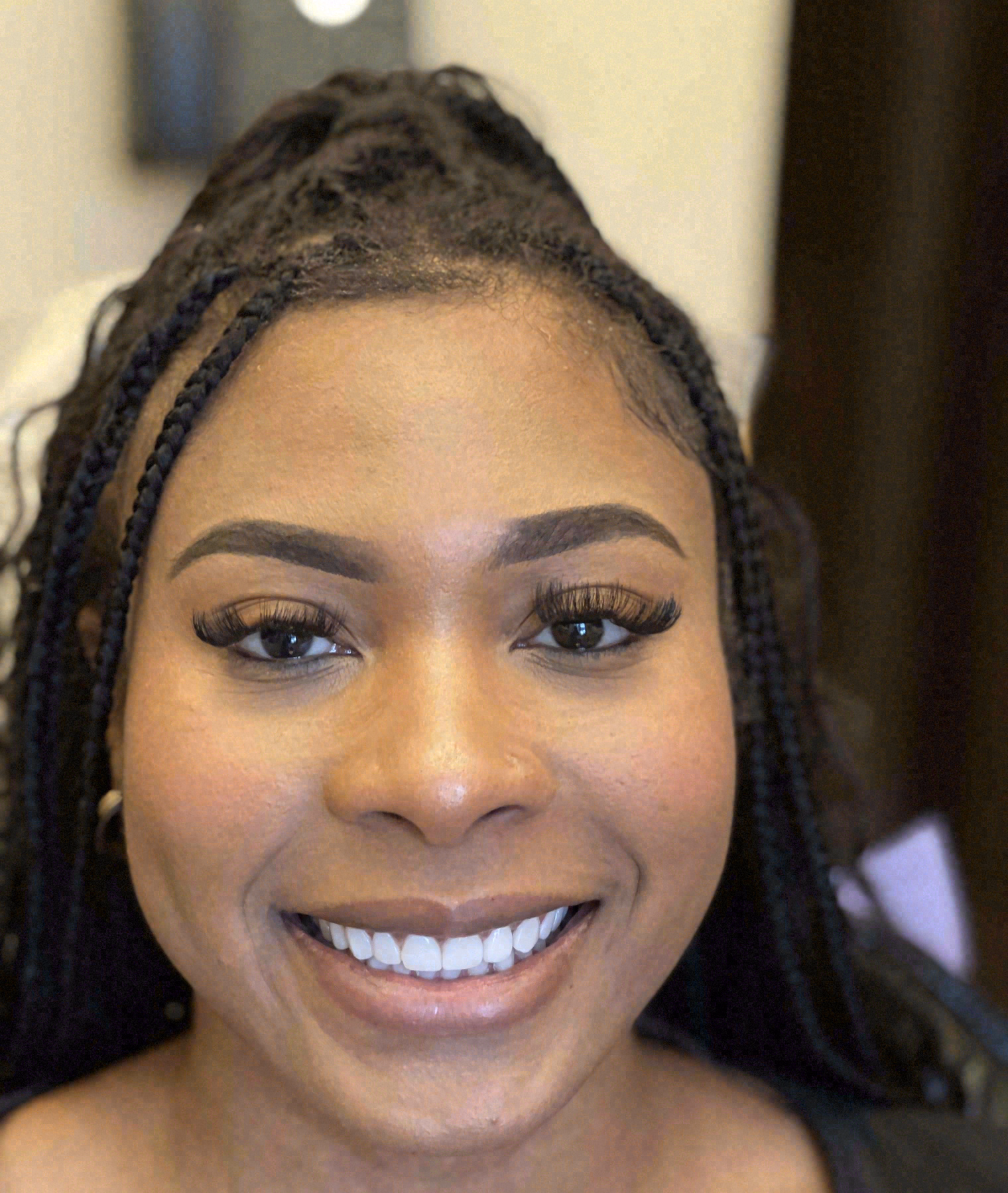 After porcelain veneers at Sola Dental Spa