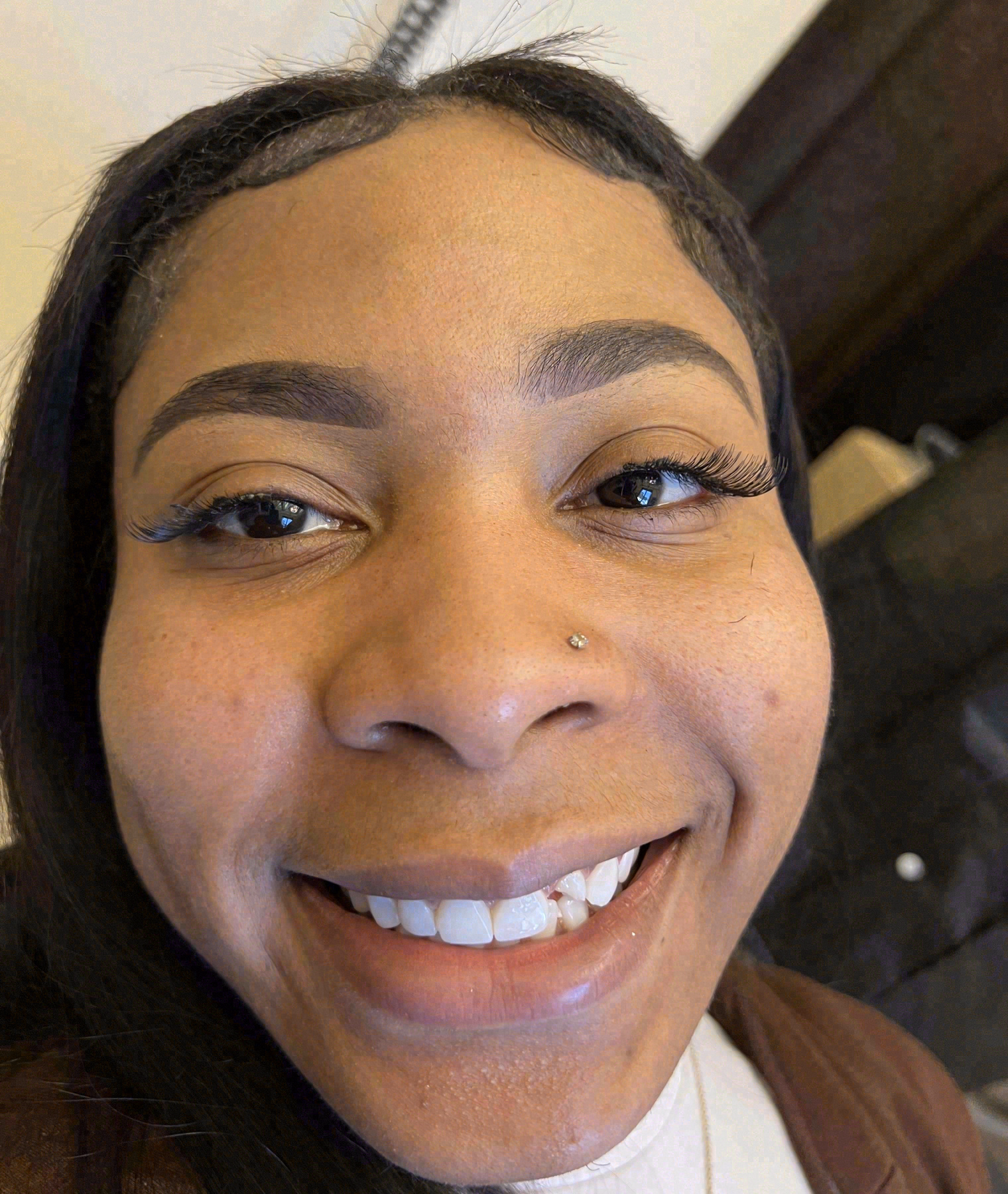 Before porcelain veneers at Sola Dental Spa