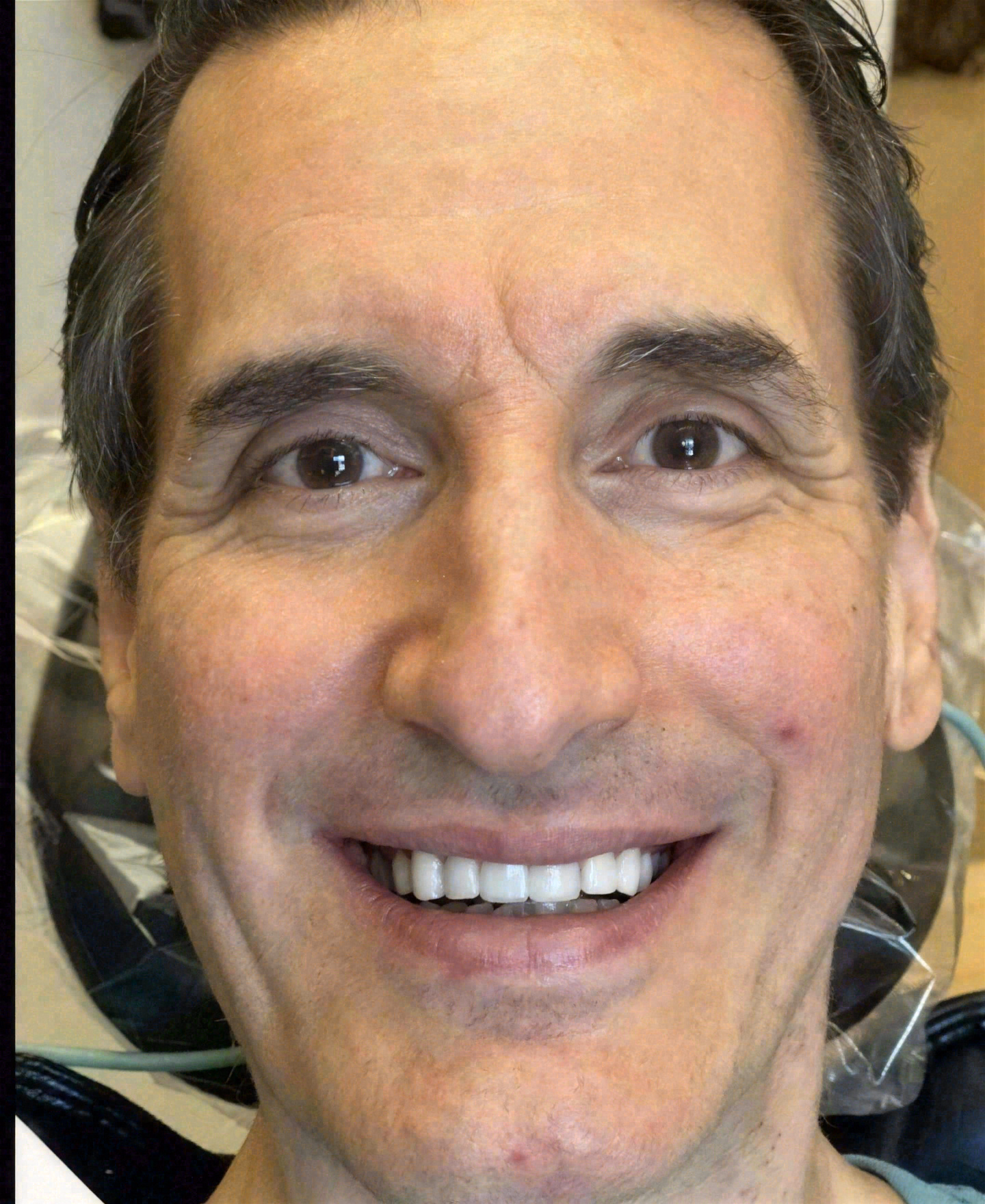 After dental implants at Sola Dental Spa
