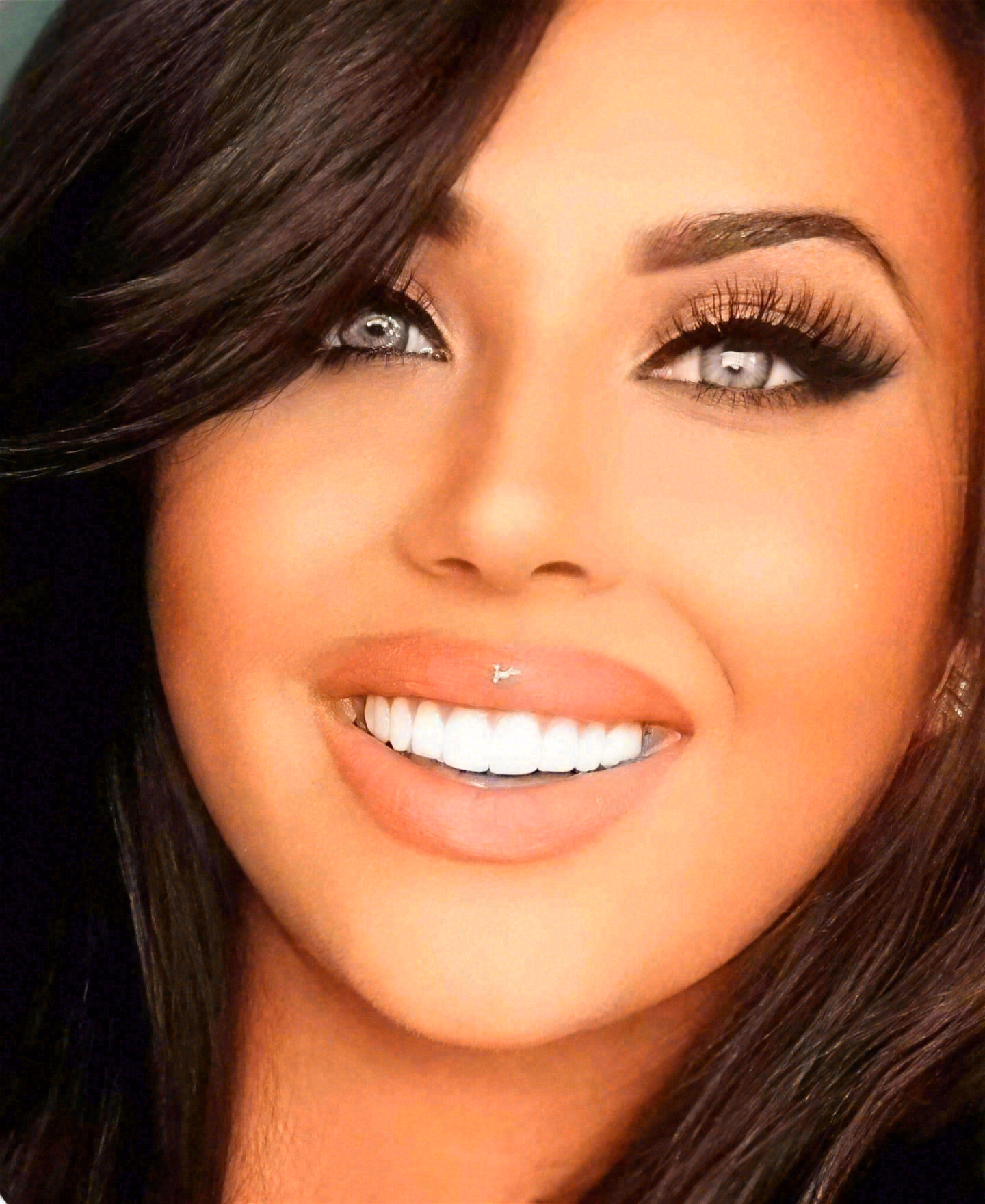 After porcelain veneers at Sola Dental Spa