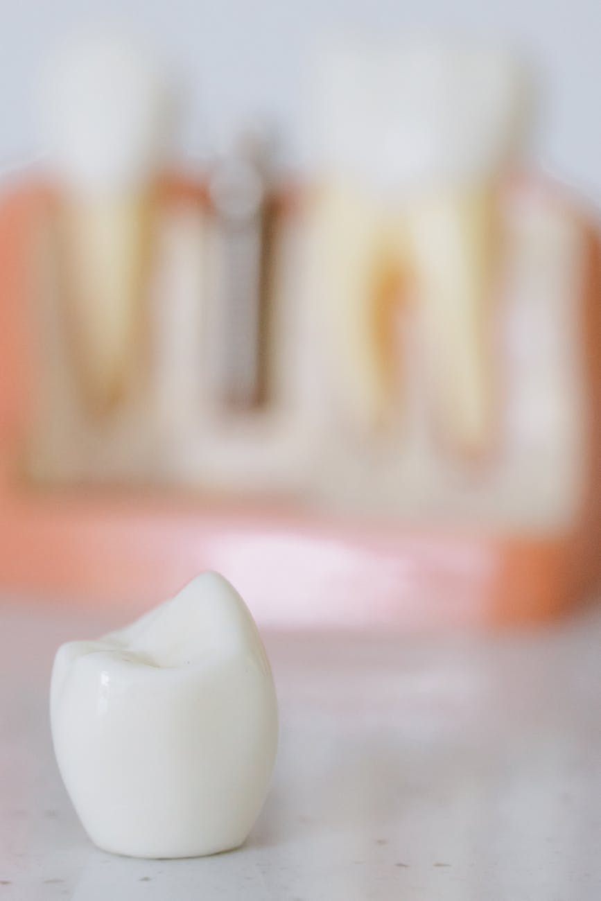 How long do dental implants last