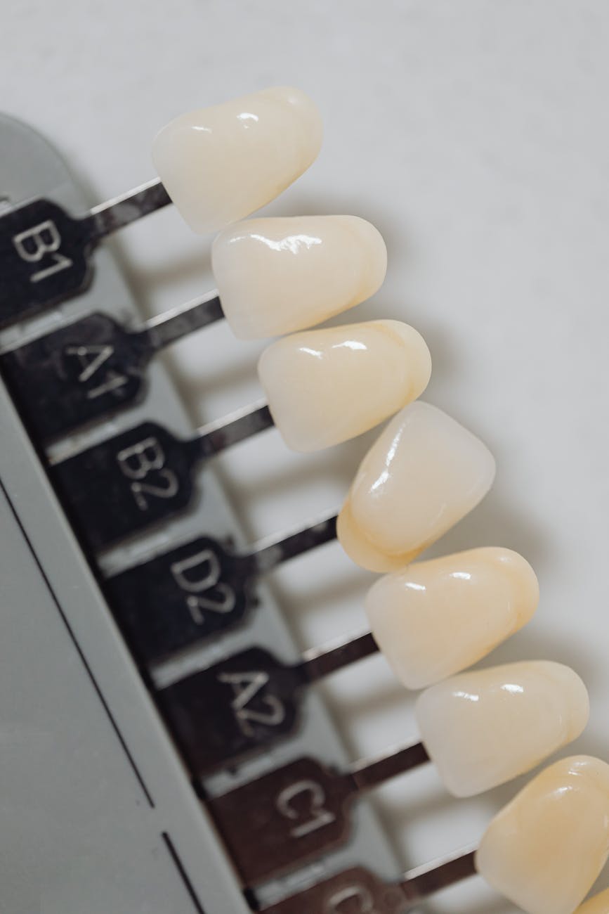 Smile makeover procedures