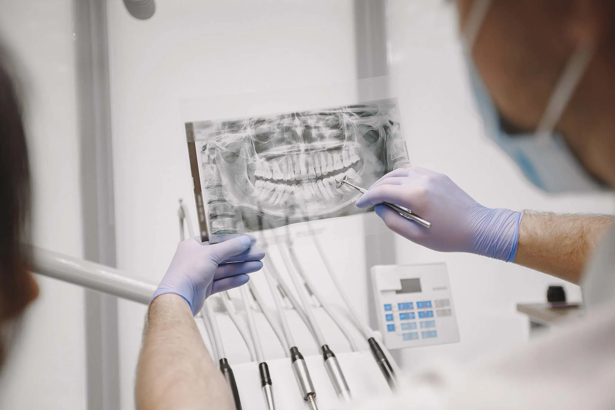 Amalgam Filling Replacement