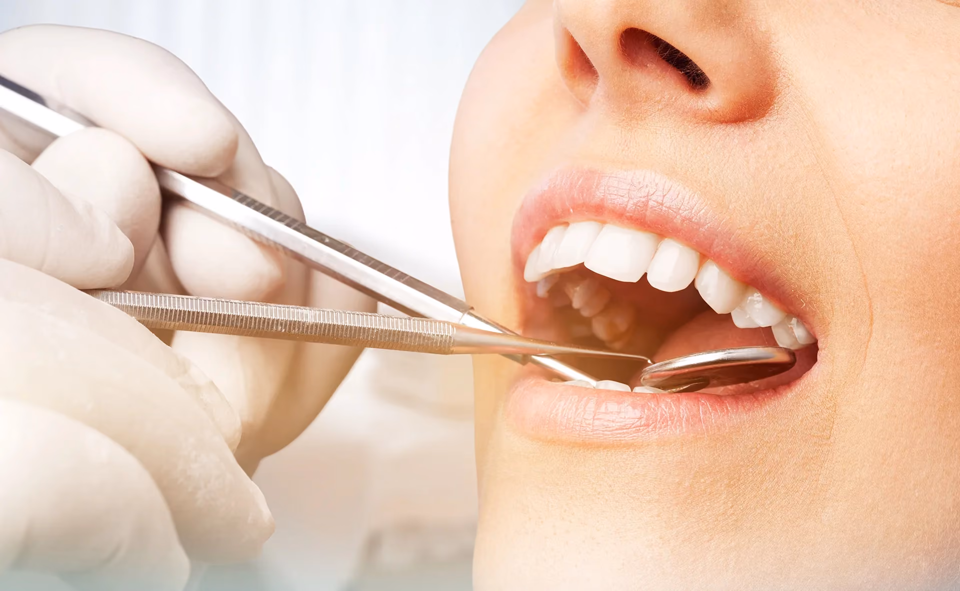 Periodontal Care