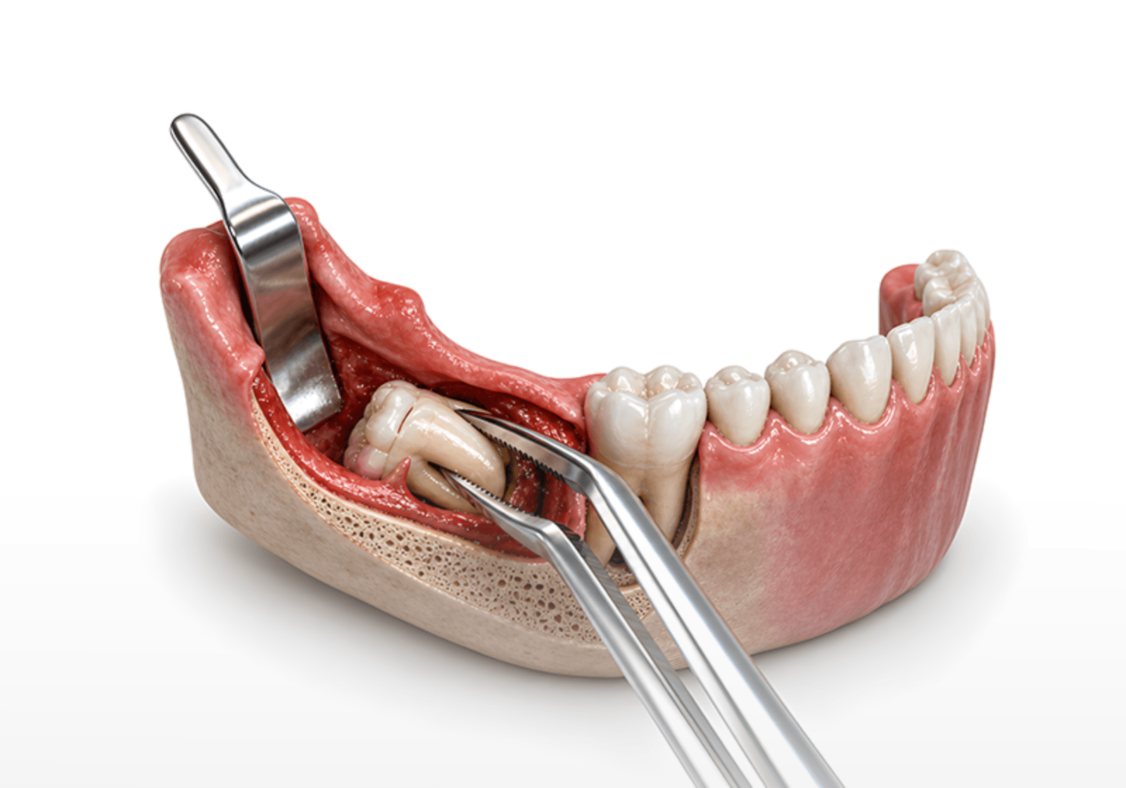 Oral Surgery