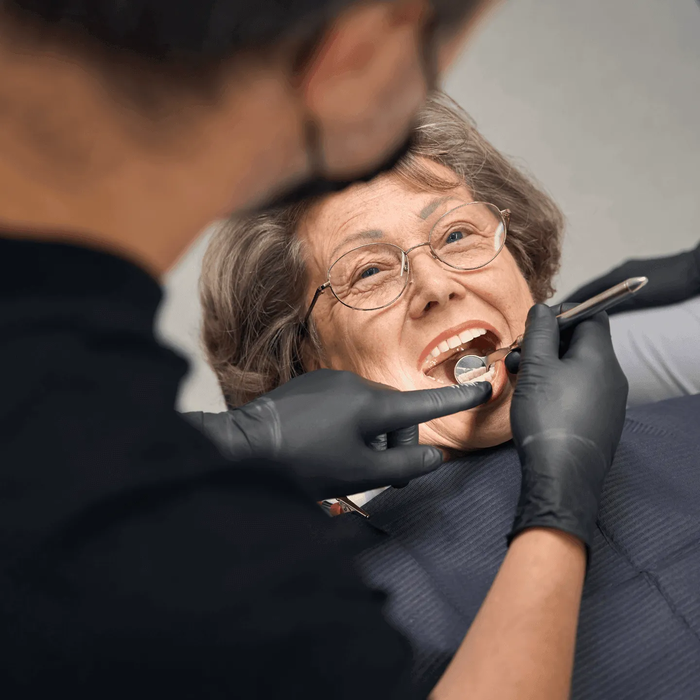 full mouth restoration service