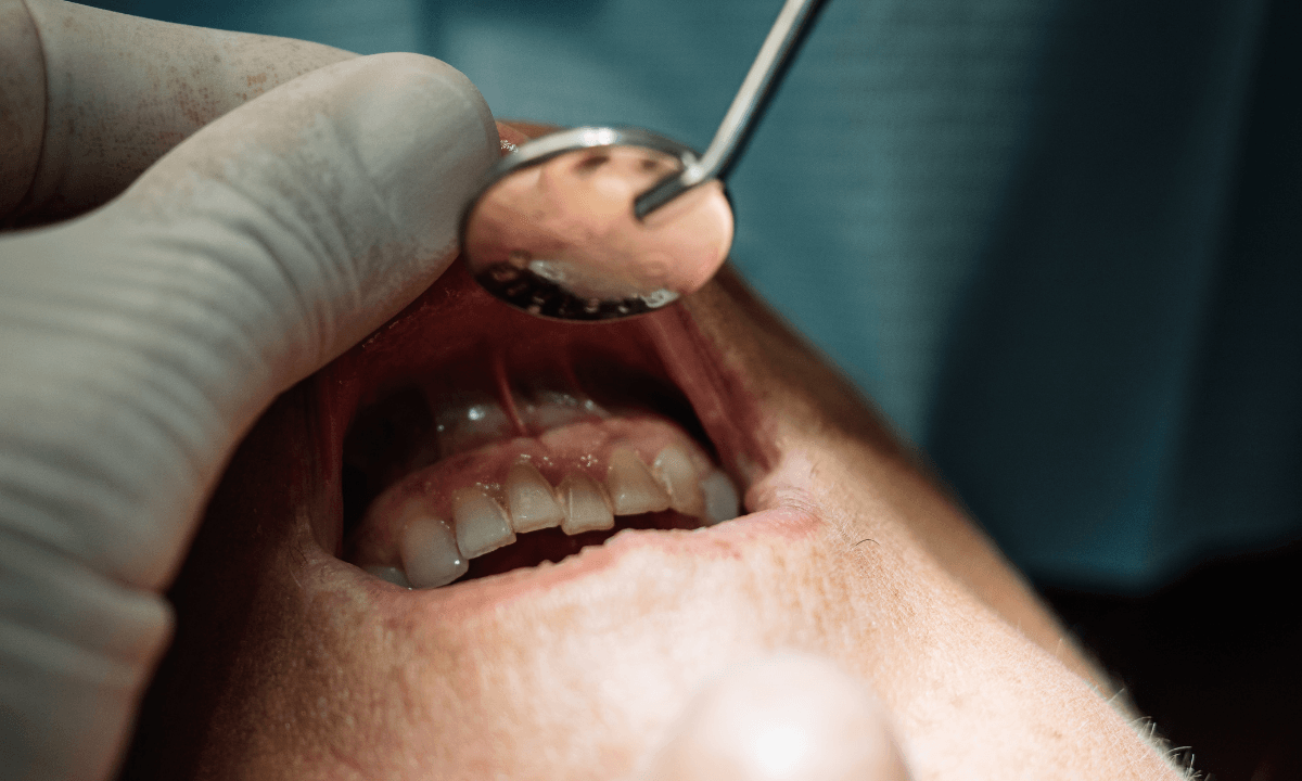 Dental implants services