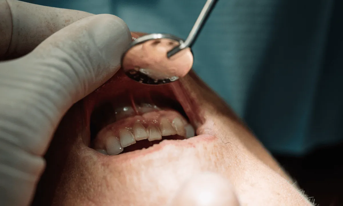 Dental implants services