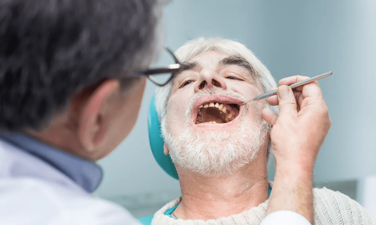 Full mouth reconstruction