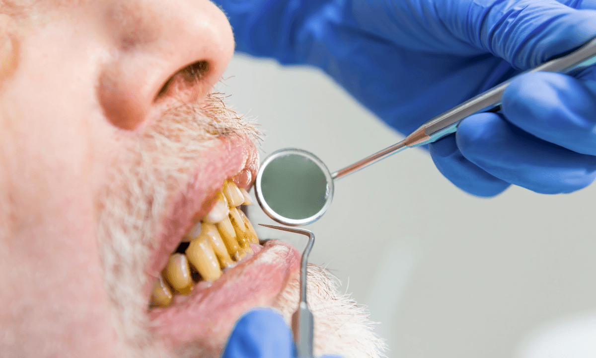 Tooth replacement