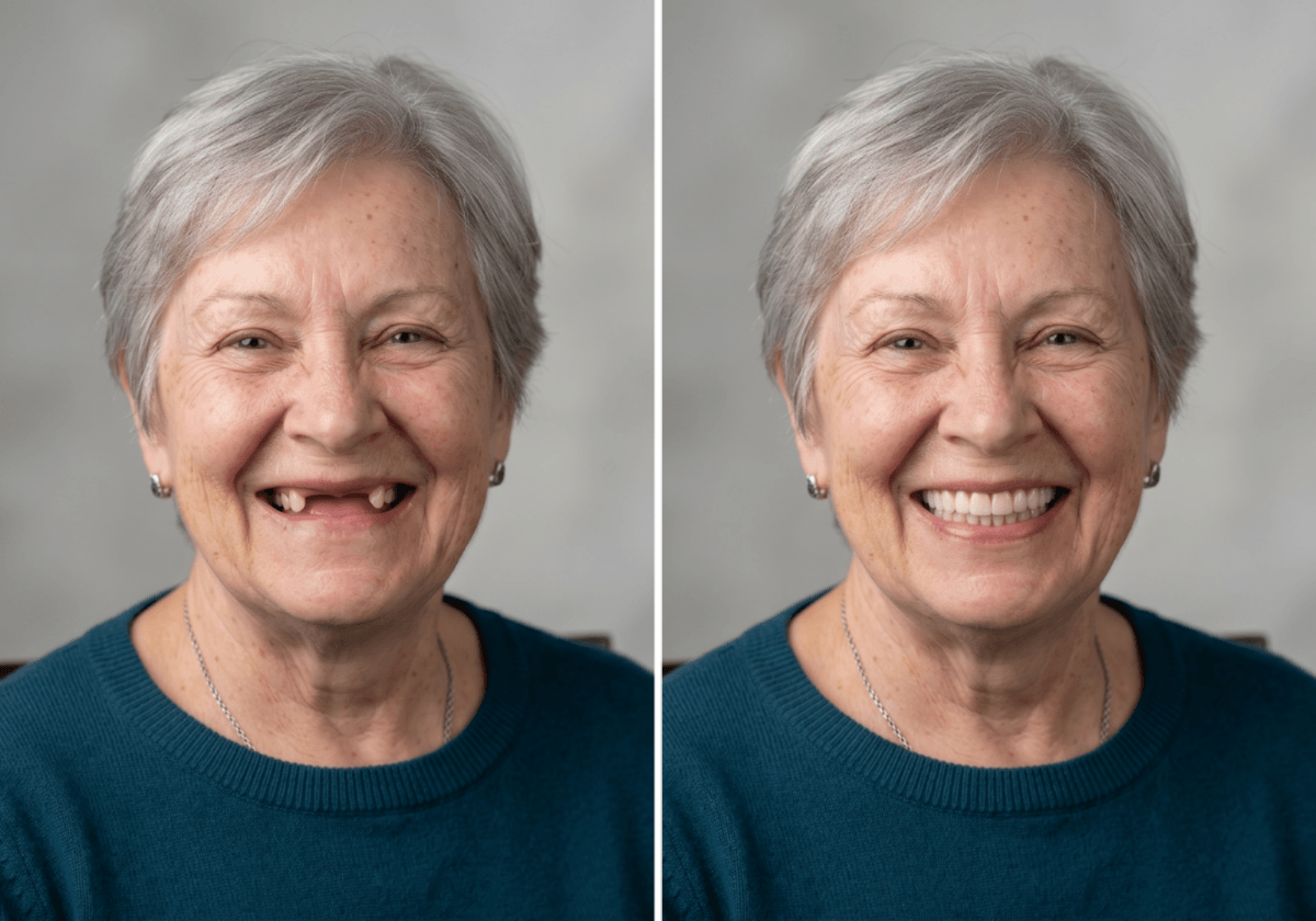 Adult dentistry services