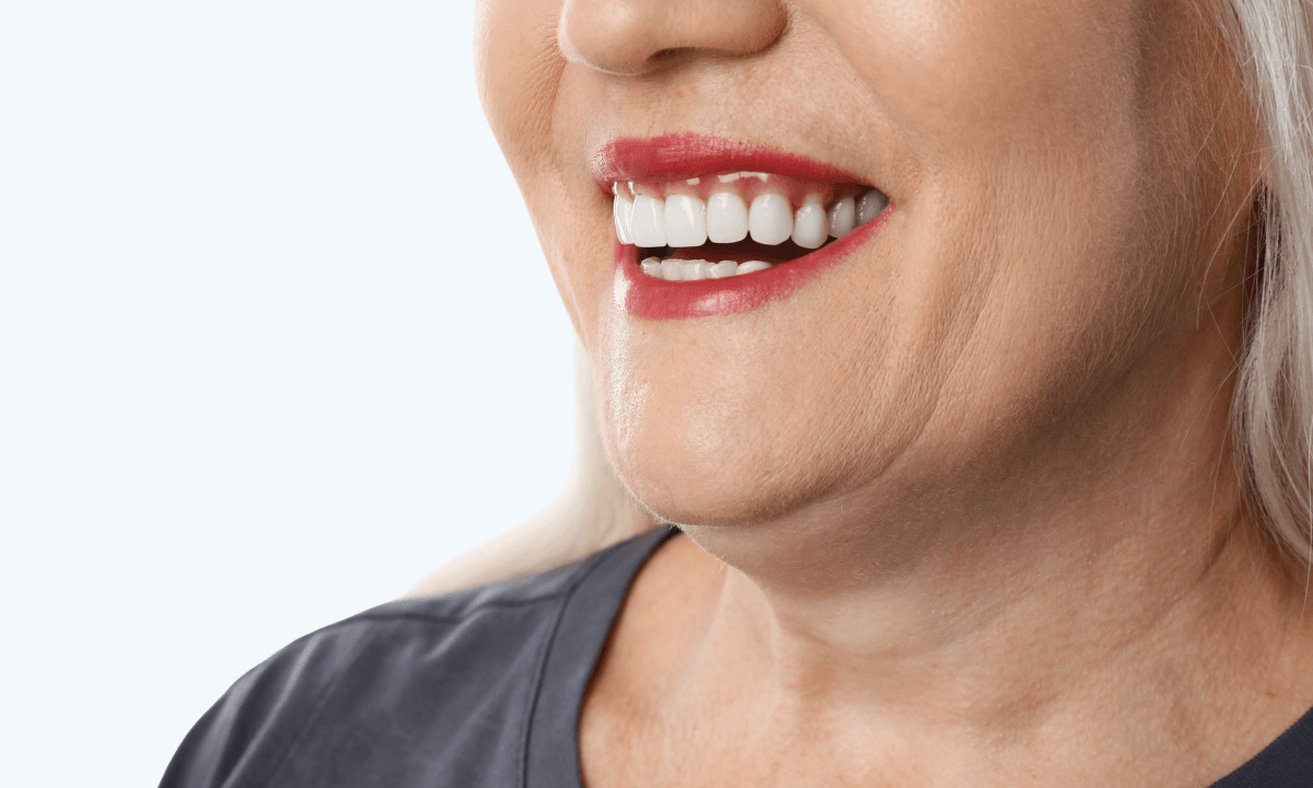 Crown & Veneers service
