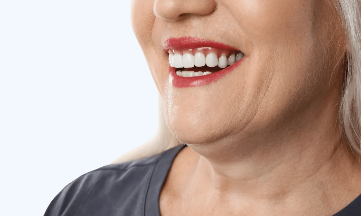 Crown & Veneers service