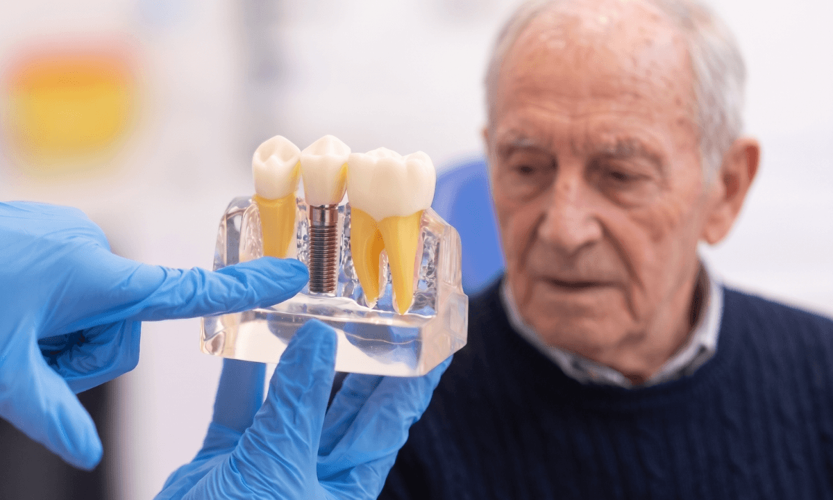 Dental bridges