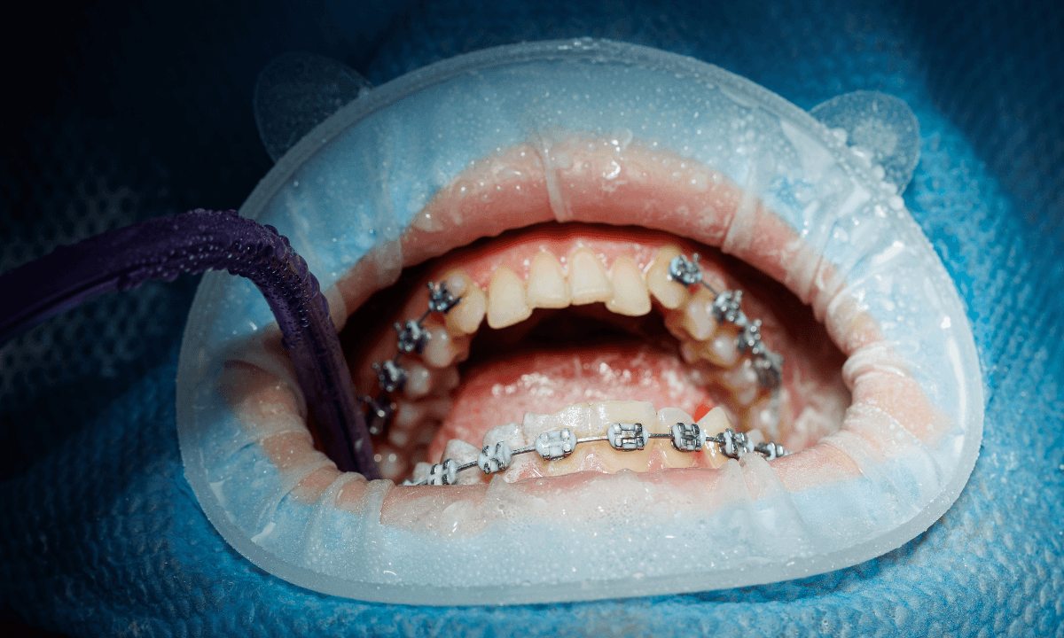Oral surgery service