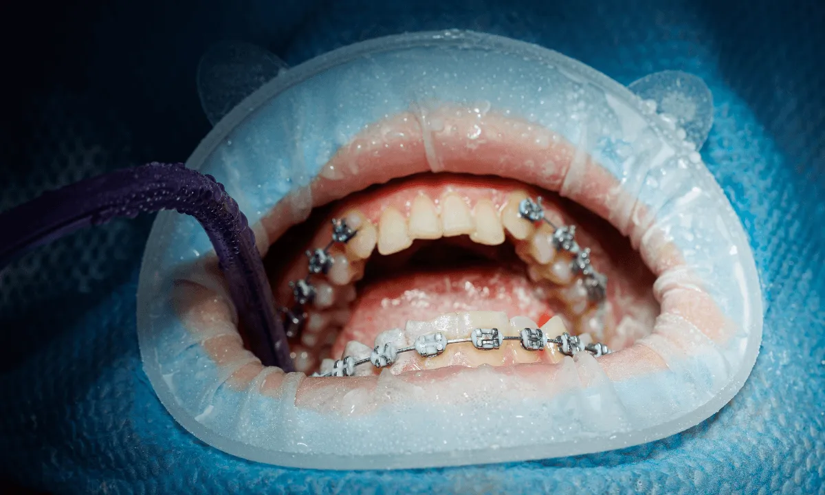 Oral surgery service