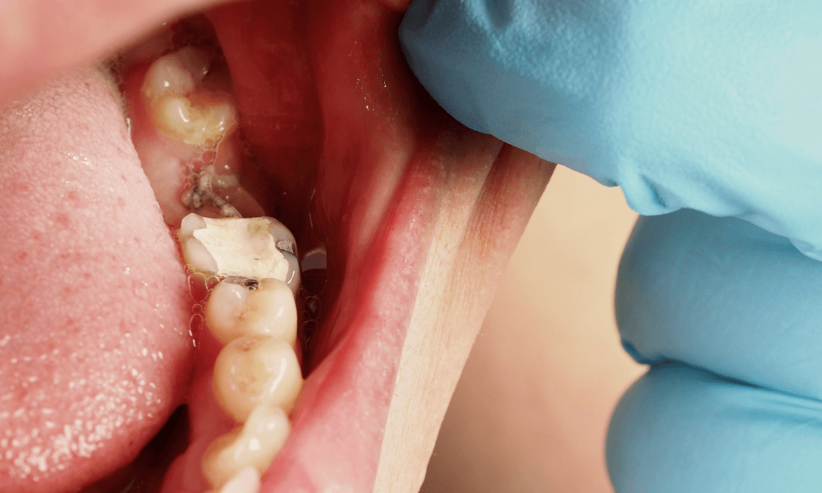 Emergency Dentist