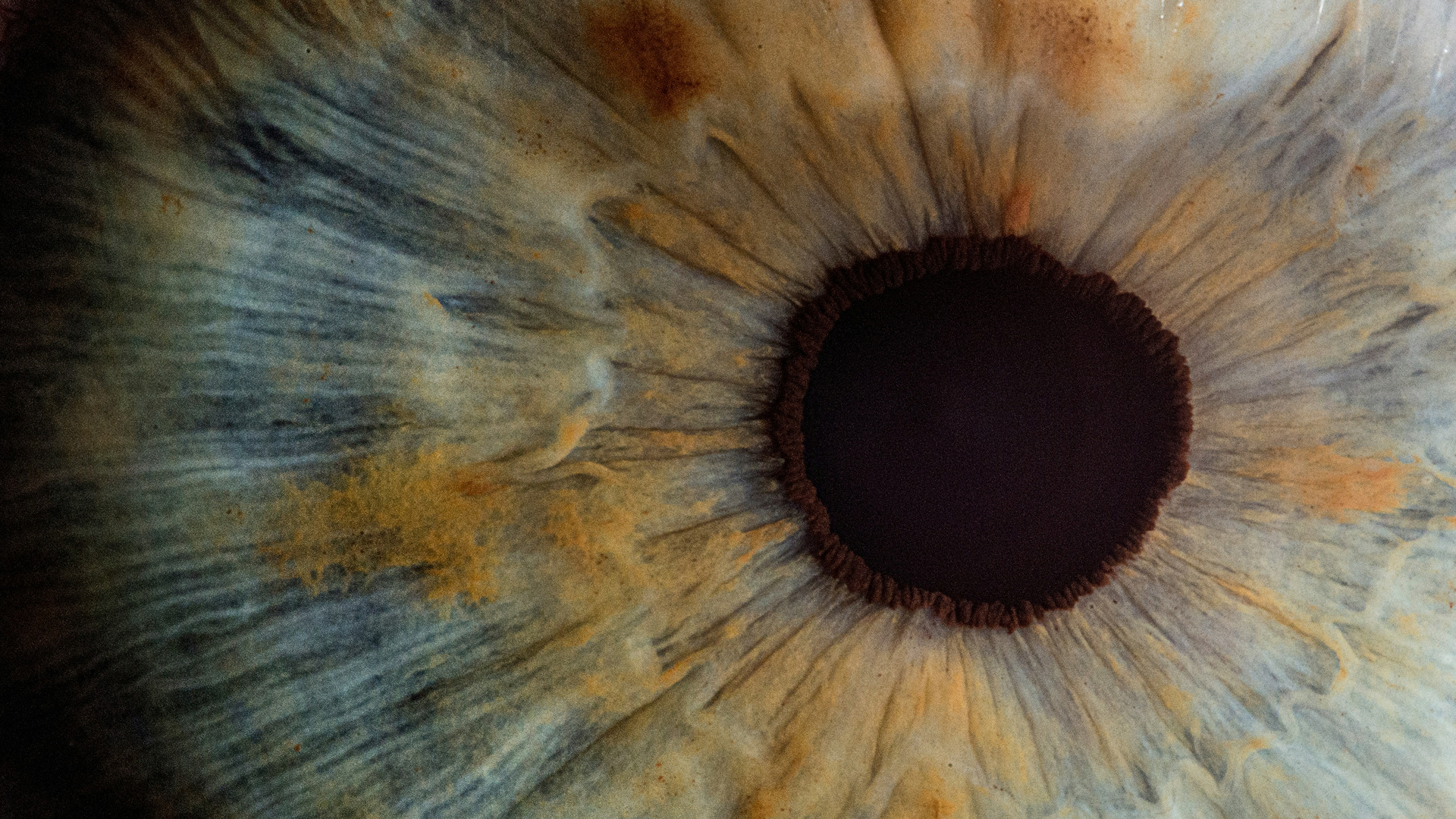 Close-up macro photo of a blue and brown human eye iris with visible texture and central pupil.