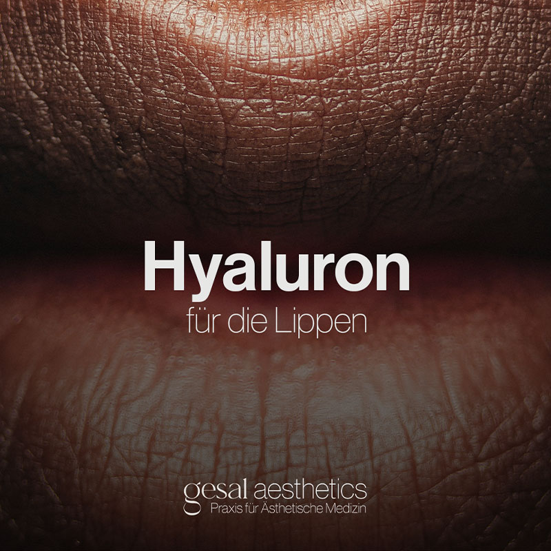 Nahaufnahme von Lippen mit der Beschriftung Hyaluron für die Lippen und Praxis für Ästhetische Medizin.