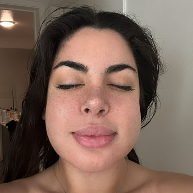 Close-up of a woman with before facelift surgery